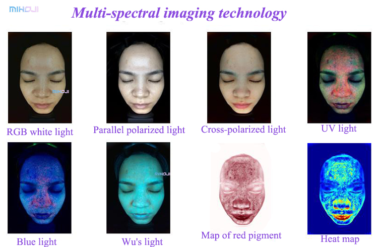 Touch Screen Skin Analysis Device 3D For Wrinkle And Pigmentation Detection