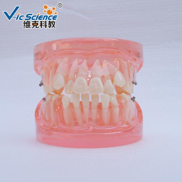 Buy cheap Natural Size Dental Study Models VIC-B2 24pcs Plastic Orthodontic Teeth Model from wholesalers