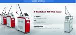 New design Laser nd yag q-switched laser nd yag q-switched tattoo removal