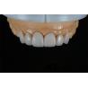Buy cheap Natural Porcelain E-Max Crown Full Veneer In Demistry Restorations from wholesalers