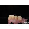 Buy cheap High Stealth Flexible Removable Denture Finished Comfortable Fit Dental Lab from wholesalers