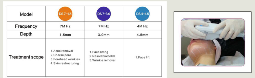 popular beauty machine high intensity focused ultrasound hifu