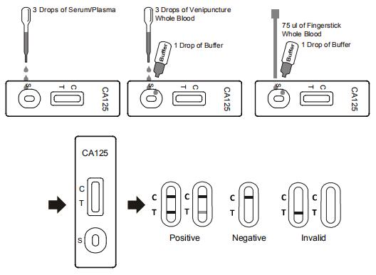 98.0% Specificity One Step CA125 Rapid Test Cassette 10 Minutes Fast Reading