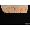 Buy cheap Thin Shell Micro Veneer Cosmetic Dental Treatment Micro Thin Teeth Veneers from wholesalers