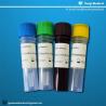Buy cheap genes ORF1ab Coronavirus Home Test Kits Complete results 40-90 mins from wholesalers