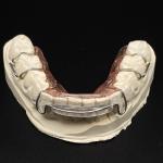 Comfortable Stainless Steel Acrylic Hawley Retainer Effective Orthodontic