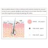 Buy cheap Non - Invasive Water Oxygen Jet Peel Machine 5 Headpieces For All Skin Type from wholesalers
