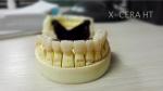 High Translucency Tooth Crown Material Zirconia Zirconia In Dentistry
