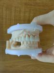 Layered Zirconia Bridge For Fixed Restoration Beautiful Smiles Professional