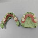 Flexibility Meets Invisibility Dental Flexible Resin for Full Dentures