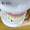 Buy cheap Dental Multi Implant Cases Customized Implant Procedure Cases from wholesalers