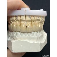 Buy cheap Seamless PFM Porcelain Fused Metal Crown For Long Term Biocompatible Restoration product