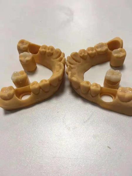 Buy cheap Trustworthy Precise Dental Ceramic Inlays And Onlays Customizable from wholesalers