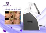 35 * 38 * 58cm HIFU Machine , English Language Non Surgical Face Lift Machine