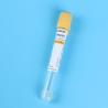 Buy cheap Disposable Yellow Cap PET Vacuum Pro Coagulation Tube 1ml - 10ml from wholesalers