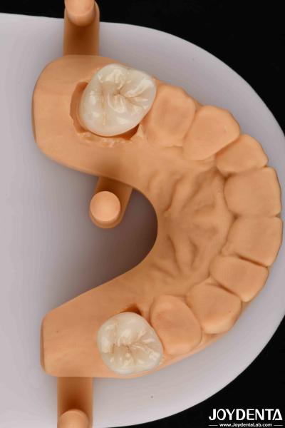 Buy cheap Natural-looking Esthetics With Biocompatible Dental Zirconia Winning Combination from wholesalers