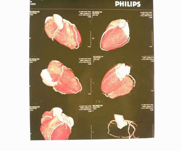 Buy cheap Waterproof X Ray Diagnostic Imaging Medical Paper For Laser Printers KND-K from wholesalers
