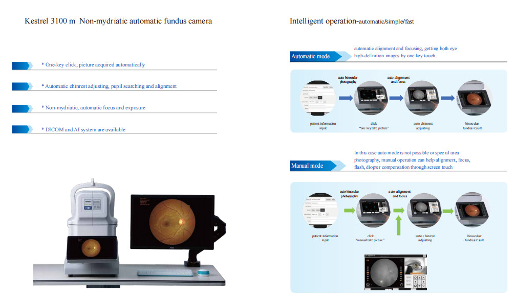 Digital Eye Fundus Imaging Camera 50HZ Intelligent Operation