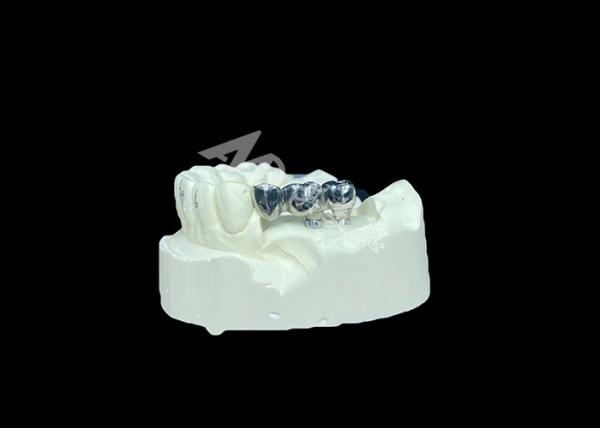 Buy cheap Long-lasting Full Cast Titanium Crown Dental Implant Molar For Missing Teeth Replacement from wholesalers