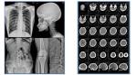 Blue Inkjet Medical X Ray Film Medical Dry Film A4 Sheet Or In Roll No Reviews