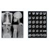 Buy cheap A4 Size Sheets Blue Inkjet Medical Film For Medical Image from wholesalers