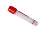 Biochemical Immunological Bd Clot Activator Tubes 0.5ml 1ml 1.6ml 2ml