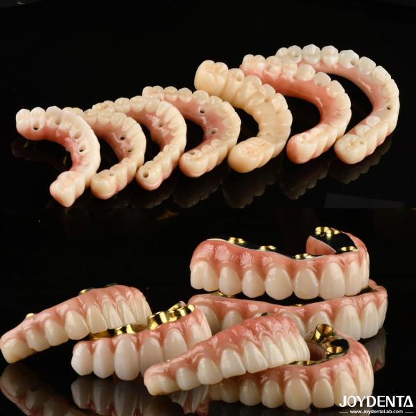 Buy cheap Implant Crown and Bridge The Trusted and Proven Choice for Dental Reconstruction from wholesalers