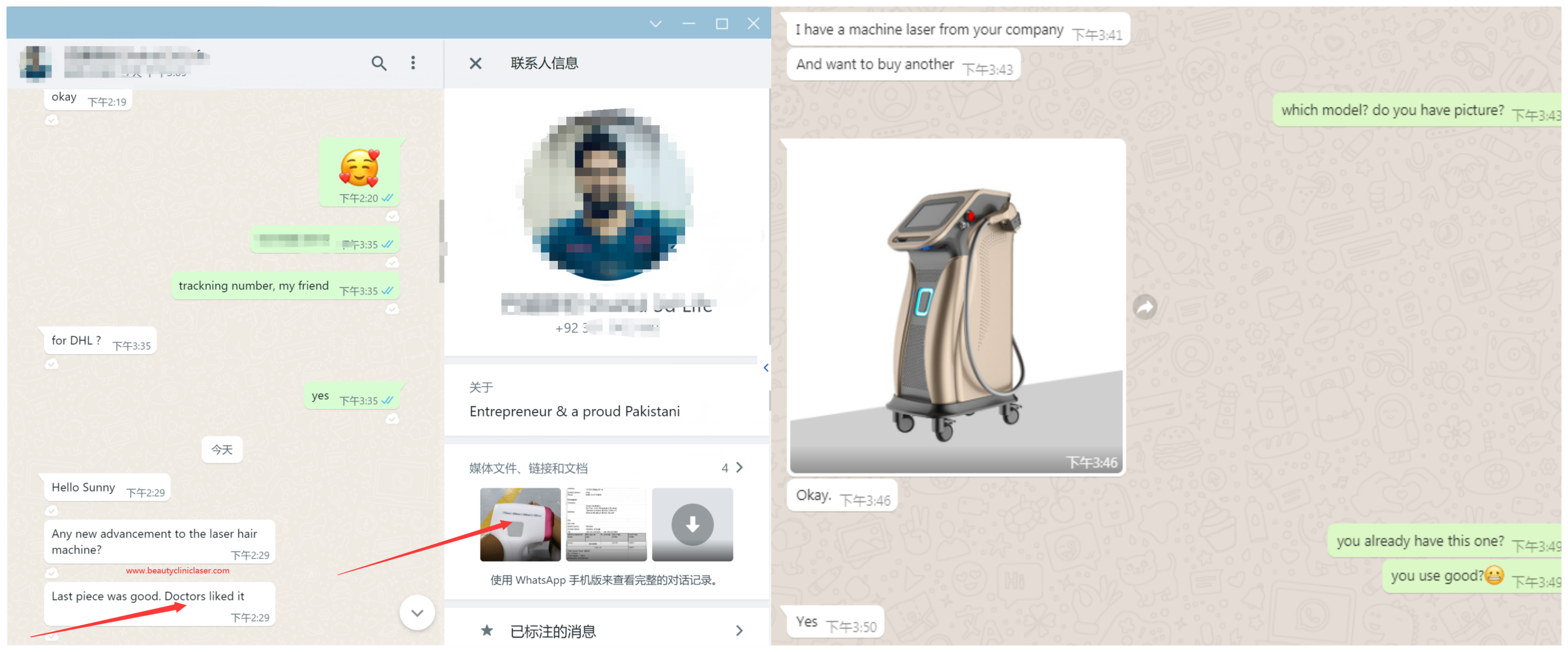 professional diode laser hair removal machine