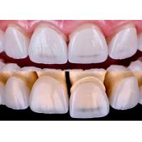 Buy cheap Long Lasting Dental EMAX Veneer Fabricated With All Ceramic Zirconium Material product