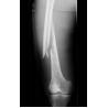 Buy cheap Konida Laser X Ray Medical Imaging from wholesalers