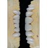 Buy cheap Glossy Surface Texture Feldspathic Veneer Natural Looking Porcelain Veneer from wholesalers