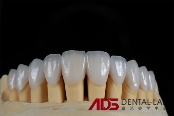 Buy cheap Feldspathic Porcelain Laminate Dental Veneer Seamless Customized from wholesalers