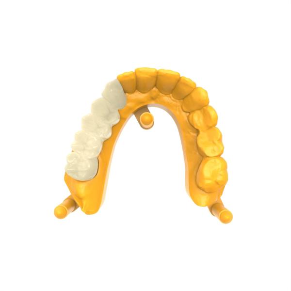 Buy cheap Permanent Crown Bridge Resin with 2 Years Shelf Life and High Shore D 92 from wholesalers