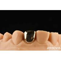 Buy cheap Experience Oral Rehabilitation Like Never Before With Gold Crown Wax Casting product