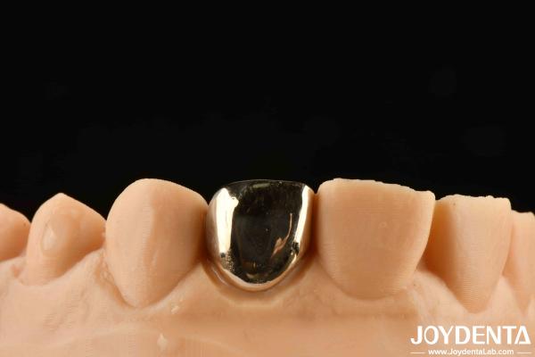 Buy cheap Experience Oral Rehabilitation Like Never Before With Gold Crown Wax Casting from wholesalers
