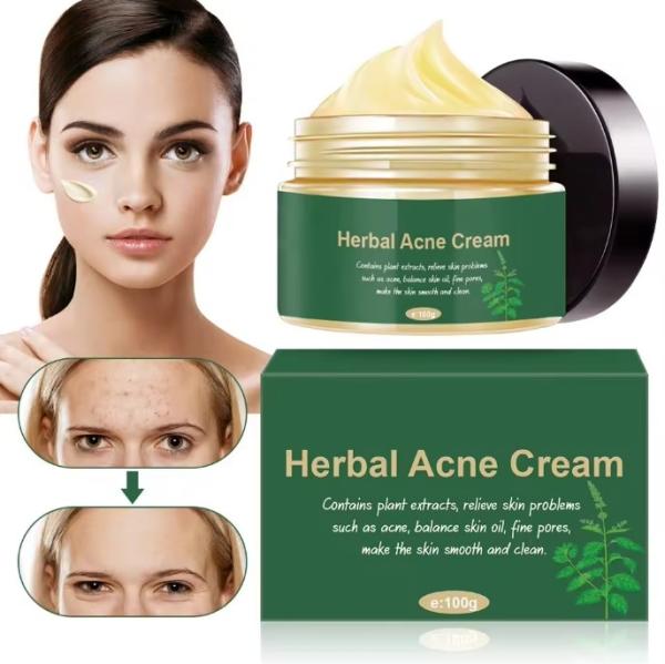 Buy cheap Organic Herbal Anti Acne Remover Pimple Treatment Repair Scar Cream from wholesalers