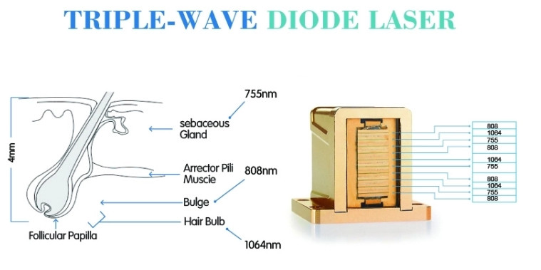 best hair removal 808nm lumenis diode laser hair removal machine