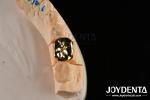 Abrasive Resistance Dental Wax Casting FMC Crown For Oral Clinical Repair