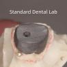 Buy cheap Dental Restoration Metal Post And Core Crown Perfect Fit from wholesalers
