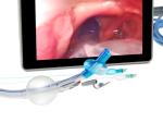 Video Double Lumen Endobronchial Tube Direct and Accurate Positioning