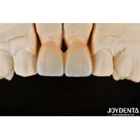 Buy cheap 1350-1450°C Sintering Temperature Layered Zirconia For Superior Biocompatibility product