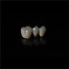 Buy cheap Anti Wear Implant PFM Dental Bridge Prosthesis Teeth Replacement from wholesalers