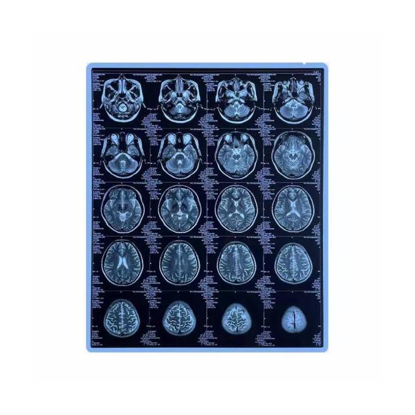 Buy cheap CE Printable Blue Medical X Ray Film 11x14 Inch Pet Inkjet Film from wholesalers
