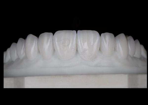 Translucency Natural Esthetic Zirconia Crowns Excellent Biocompatibility And