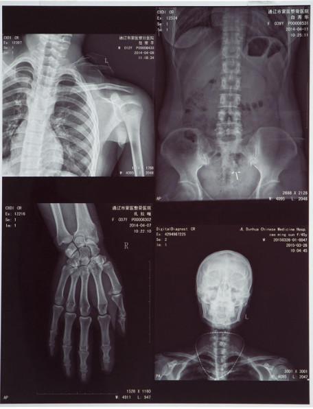 Buy cheap Blue Color 10X12 Inch Inkjet Pet Medical X-ray Film/Image from wholesalers