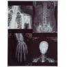 Buy cheap Blue Color 10X12 Inch Inkjet Pet Medical X-ray Film/Image from wholesalers