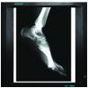 Buy cheap agfa Dry Digital X ray Film For Medical , CE / SFDA / ISO 13485 from wholesalers