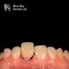 Buy cheap Hypoallergenic Dental Implant Zirconia Abutment Biocompatible from wholesalers