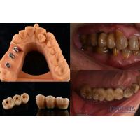 Buy cheap Ultra Hard Colour Stability Dental Implant Crown OEM Easy Maintain Long Lasting product