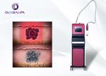 1064 532nm Pico Second Laser Tattoo Removal Machine With Four Treatment Heads